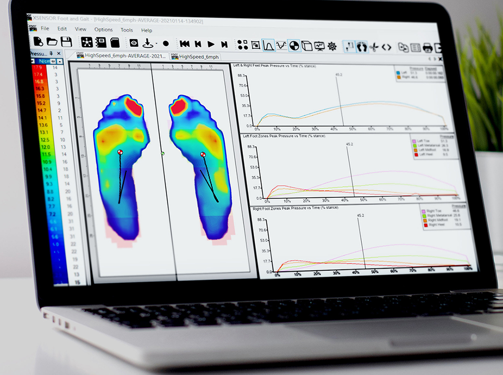 XSENSOR Technology's Pro Foot & Gait software showing plantar pressure data on a laptop.