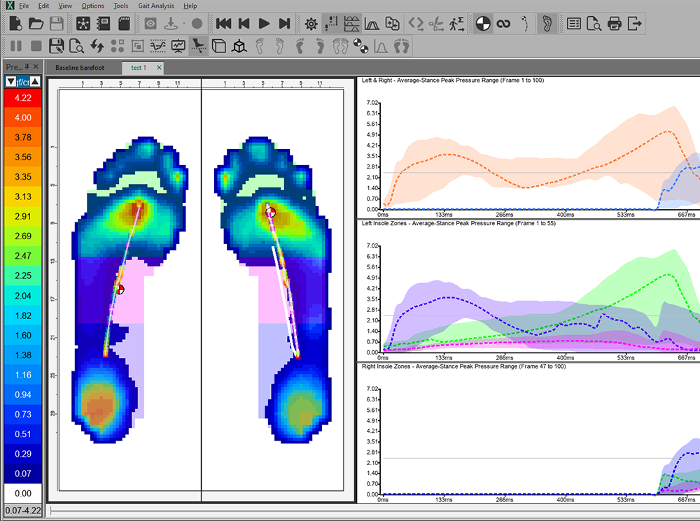 XSENSOR's Clinical Foot & Gait software showing the plantar pressure data of two feet.