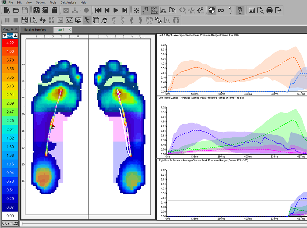 XSENSOR's Clinical Foot & Gait software showing the plantar pressure data of two feet. XSENSOR's Clinical Foot & Gait software showing the plantar pressure data of two feet.