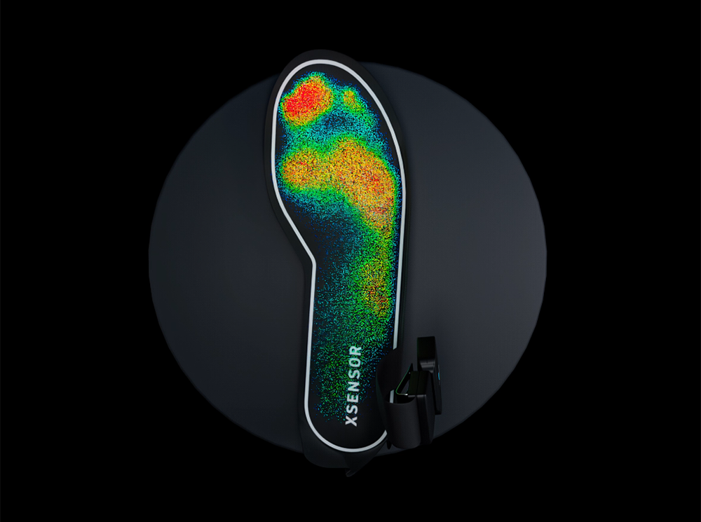XSENSOR's Intelligent Insoles system showing plantar pressure map of a foot. XSENSOR's Intelligent Insoles system showing plantar pressure map of a foot.