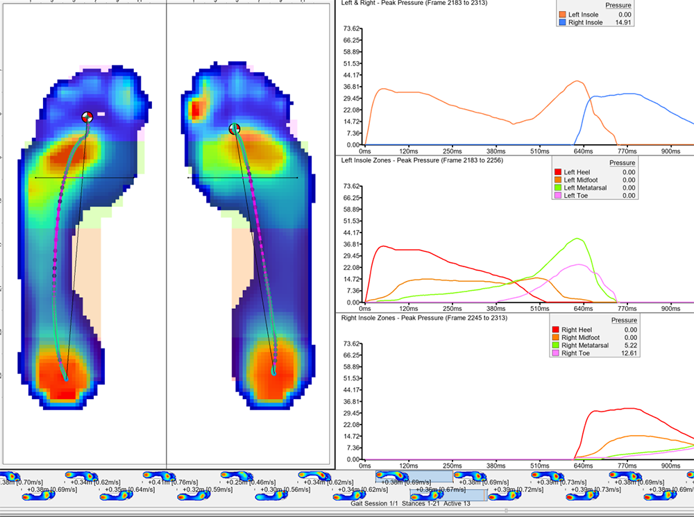 XSENSOR's Pro Foot & Gait software showing plantar pressure data from two feet.