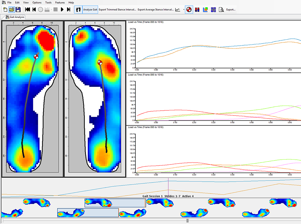 XSENSOR's Foot & Gait Pro software showing plantar pressure data of two feet.