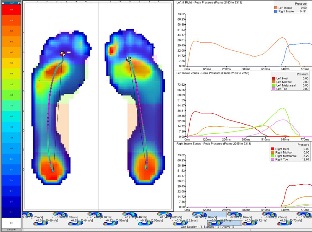 XSENSOR's Intelligent Insoles pressure data showing two plantar pressure feet.