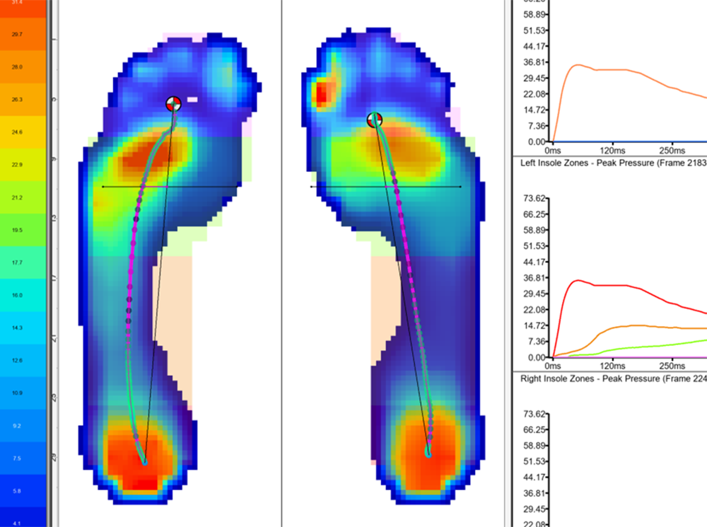 Plantar pressure data from XSENSOR's Pro Foot & Gait software.