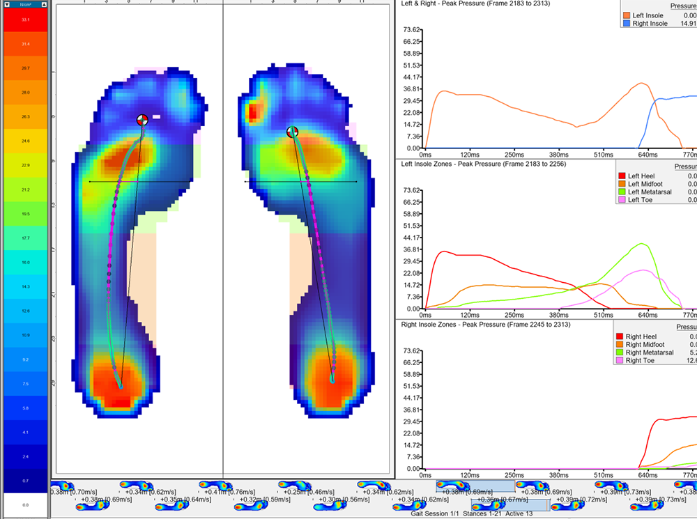 Plantar pressure data from XSENSOR's Pro Foot & Gait software.