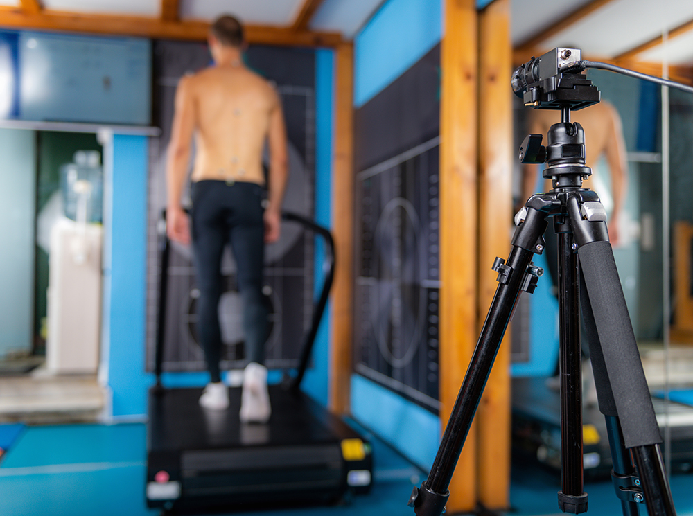 Video analysis of a patient walking on a treadmill.